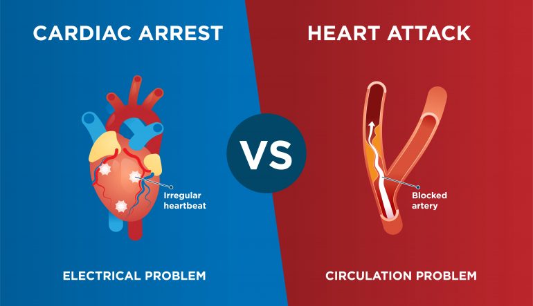 Differences Between Heart Attack And Cardiac Arrest Rapid Response Revival