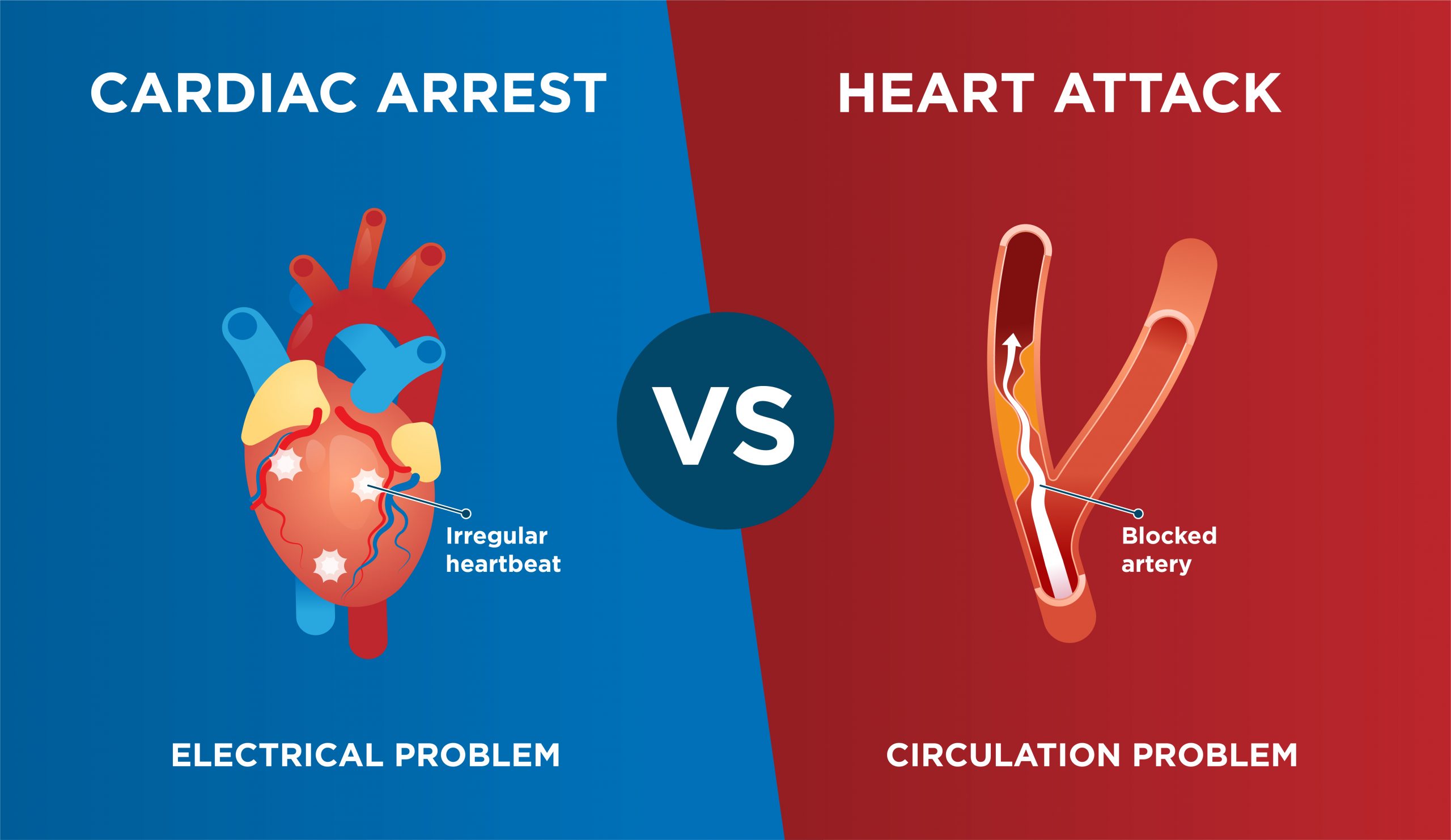 Difference between cardiac arrest and heart attack after Damar